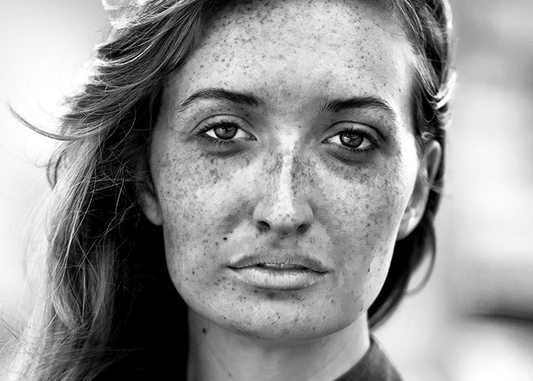 Skin Concern: Dark Spots