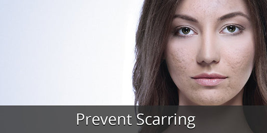 Prevent Scars